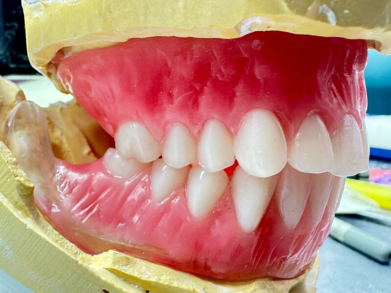 Classic Dental Lab — UK Dental Laboratory for Crowns, Dentures & Implants photo